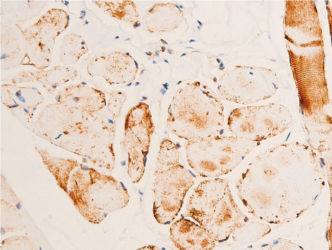 CHEK1 / CHK1 Antibody - 1:100 staining human heart tissue by IHC-P. The tissue was formaldehyde fixed and a heat mediated antigen retrieval step in citrate buffer was performed. The tissue was then blocked and incubated with the antibody for 1.5 hours at 22°C. An HRP conjugated goat anti-rabbit antibody was used as the secondary.