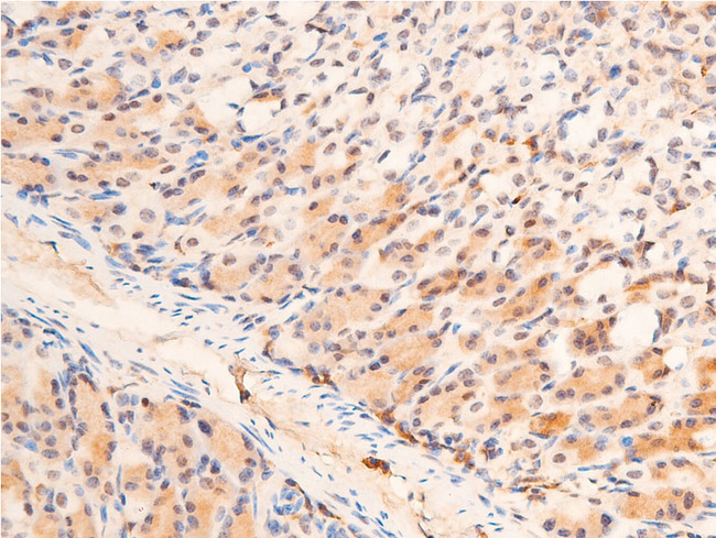 CHEK1 / CHK1 Antibody - 1:100 staining mouse gastric tissue by IHC-P. The tissue was formaldehyde fixed and a heat mediated antigen retrieval step in citrate buffer was performed. The tissue was then blocked and incubated with the antibody for 1.5 hours at 22°C. An HRP conjugated goat anti-rabbit antibody was used as the secondary.