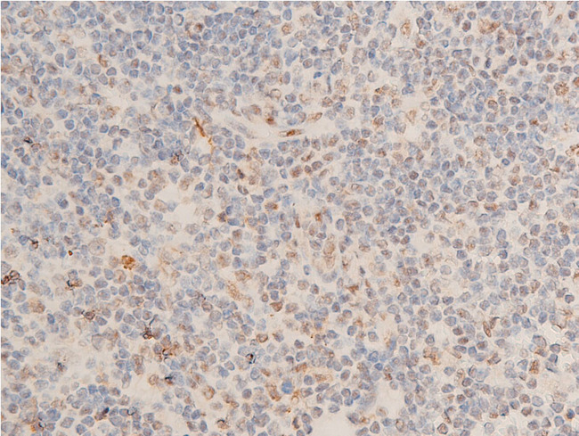 CHEK1 / CHK1 Antibody - 1:100 staining human appendix tissue by IHC-P. The tissue was formaldehyde fixed and a heat mediated antigen retrieval step in citrate buffer was performed. The tissue was then blocked and incubated with the antibody for 1.5 hours at 22°C. An HRP conjugated goat anti-rabbit antibody was used as the secondary.