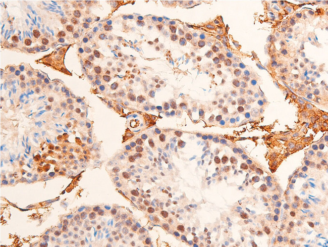 CHEK1 / CHK1 Antibody - 1:100 staining mouse testis tissue by IHC-P. The tissue was formaldehyde fixed and a heat mediated antigen retrieval step in citrate buffer was performed. The tissue was then blocked and incubated with the antibody for 1.5 hours at 22°C. An HRP conjugated goat anti-rabbit antibody was used as the secondary.