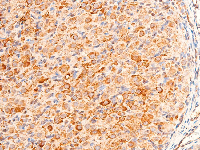 CHEK1 / CHK1 Antibody - 1:100 staining rat ovarian tissue by IHC-P. The tissue was formaldehyde fixed and a heat mediated antigen retrieval step in citrate buffer was performed. The tissue was then blocked and incubated with the antibody for 1.5 hours at 22°C. An HRP conjugated goat anti-rabbit antibody was used as the secondary.