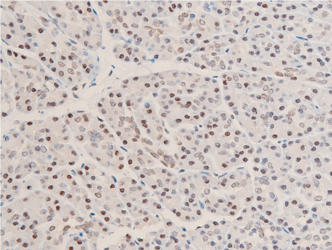 CHEK1 / CHK1 Antibody - 1:100 staining human duodenum tissue by IHC-P. The tissue was formaldehyde fixed and a heat mediated antigen retrieval step in citrate buffer was performed. The tissue was then blocked and incubated with the antibody for 1.5 hours at 22°C. An HRP conjugated goat anti-rabbit antibody was used as the secondary.