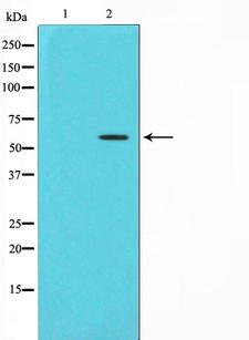 CHEK1 / CHK1 Antibody - Western blot analysis of Chk1 phosphorylation expression in UV treated HT29 whole cells lysates. The lane on the left is treated with the antigen-specific peptide.