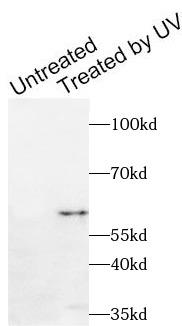 CHEK1 / CHK1 Antibody - HT-29 cells were subjected to SDS PAGE followed by western blot with anti-Phospho-CHEK1-S280 antibody at dilution of 1:1000