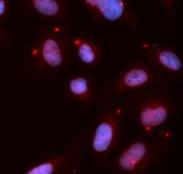 CHEK1 / CHK1 Antibody - Immunofluorescence analysis of MCF-7 cells using anti-Phospho-CHEK1-S280 antibody. Blue: DAPI for nuclear staining