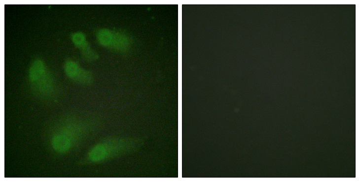 CHEK1 / CHK1 Antibody - Immunofluorescence analysis of HeLa cells, using Chk1 (Phospho-Ser286) Antibody. The picture on the right is blocked with the phospho peptide.