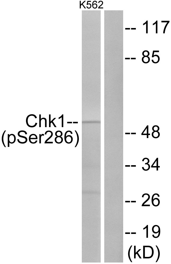 CHEK1 / CHK1 Antibody - Western blot analysis of lysates from K562 cells treated with Na3VO4 0.3uM 40', using Chk1 (Phospho-Ser286) Antibody. The lane on the right is blocked with the phospho peptide.