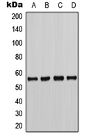 CHEK1 / CHK1 Antibody - Western blot analysis of CHK1 (pS286) expression in HeLa (A); K562 (B); NIH3T3 (C); H9C2 (D) whole cell lysates.
