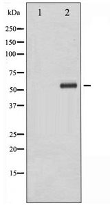CHEK1 / CHK1 Antibody - Western blot of Chk1 phosphorylation expression in Na3VO4 treated K562 whole cell lysates,The lane on the left is treated with the antigen-specific peptide.