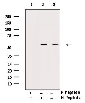CHEK1 / CHK1 Antibody - Western blot analysis of Chk1 phosphorylation expression in Na3VO4 treated 293 whole cells lysates. The lane on the left is treated with the antigen-specific peptide.