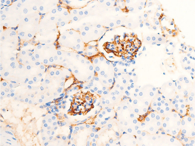 CHEK1 / CHK1 Antibody - 1:100 staining mouse kidney tissue by IHC-P. The tissue was formaldehyde fixed and a heat mediated antigen retrieval step in citrate buffer was performed. The tissue was then blocked and incubated with the antibody for 1.5 hours at 22°C. An HRP conjugated goat anti-rabbit antibody was used as the secondary.