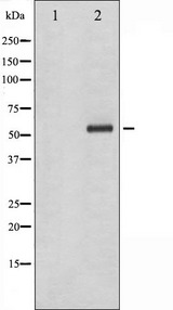 CHEK1 / CHK1 Antibody - Western blot analysis of Chk1 phosphorylation expression in Na3VO4 treated K562 whole cells lysates. The lane on the left is treated with the antigen-specific peptide.