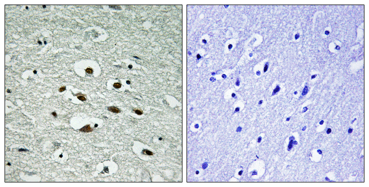CHEK1 / CHK1 Antibody - Immunohistochemistry analysis of paraffin-embedded human brain, using Chk1 (Phospho-Ser296) Antibody. The picture on the right is blocked with the phospho peptide.