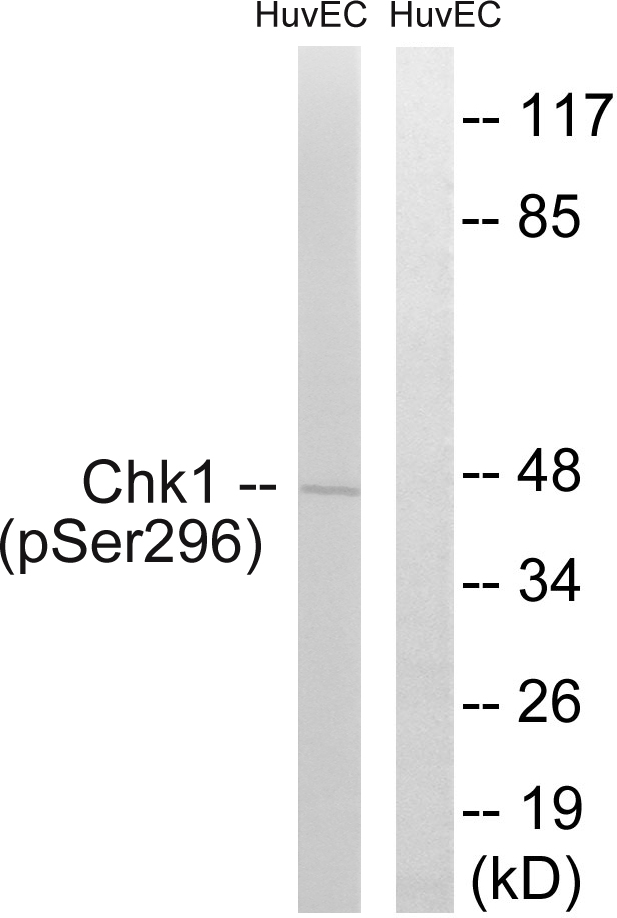 CHEK1 / CHK1 Antibody - Western blot analysis of lysates from HUVEC cells treated with UV 15', using Chk1 (Phospho-Ser296) Antibody. The lane on the right is blocked with the phospho peptide.