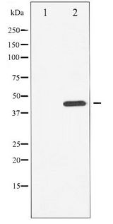 CHEK1 / CHK1 Antibody - Western blot of Chk1 phosphorylation expression in UV treated HUVEC whole cell lysates,The lane on the left is treated with the antigen-specific peptide.