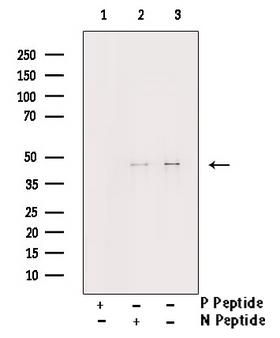 CHEK1 / CHK1 Antibody - Western blot analysis of Chk1 phosphorylation expression in UV treated HepG2 whole cells lysates. The lane on the right is treated with the antigen-specific peptide.