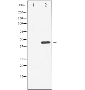 CHEK1 / CHK1 Antibody - Western blot analysis of Chk1 phosphorylation expression in UV treated HuvEc whole cells lysates. The lane on the left is treated with the antigen-specific peptide.