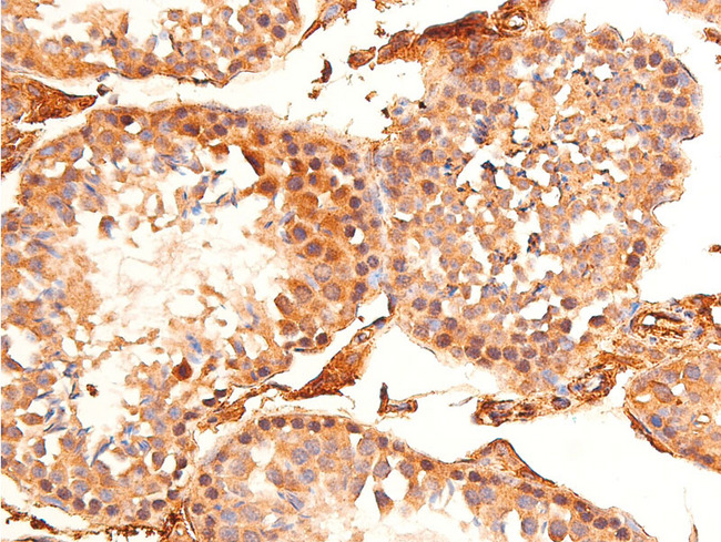 CHEK1 / CHK1 Antibody - 1:100 staining mouse testis tissue by IHC-P. The tissue was formaldehyde fixed and a heat mediated antigen retrieval step in citrate buffer was performed. The tissue was then blocked and incubated with the antibody for 1.5 hours at 22°C. An HRP conjugated goat anti-rabbit antibody was used as the secondary.