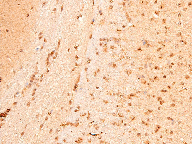 CHEK1 / CHK1 Antibody - 1:100 staining mouse brain tissue by IHC-P. The tissue was formaldehyde fixed and a heat mediated antigen retrieval step in citrate buffer was performed. The tissue was then blocked and incubated with the antibody for 1.5 hours at 22°C. An HRP conjugated goat anti-rabbit antibody was used as the secondary.