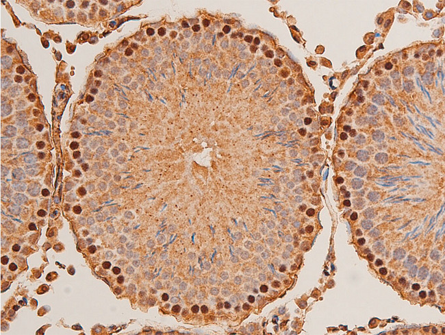 CHEK1 / CHK1 Antibody - 1:100 staining rat testis tissue by IHC-P. The tissue was formaldehyde fixed and a heat mediated antigen retrieval step in citrate buffer was performed. The tissue was then blocked and incubated with the antibody for 1.5 hours at 22°C. An HRP conjugated goat anti-rabbit antibody was used as the secondary.