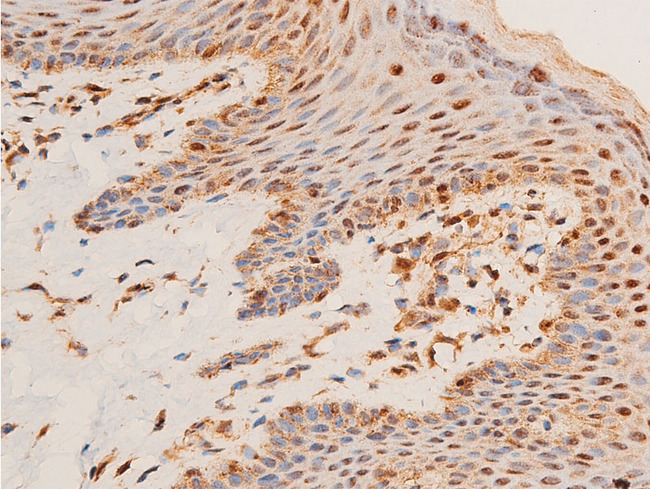 CHEK1 / CHK1 Antibody - 1:100 staining human skin tissue by IHC-P. The tissue was formaldehyde fixed and a heat mediated antigen retrieval step in citrate buffer was performed. The tissue was then blocked and incubated with the antibody for 1.5 hours at 22°C. An HRP conjugated goat anti-rabbit antibody was used as the secondary.
