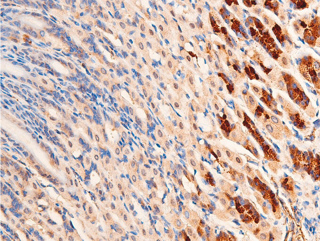 CHEK1 / CHK1 Antibody - 1:100 staining mouse gastric tissue by IHC-P. The tissue was formaldehyde fixed and a heat mediated antigen retrieval step in citrate buffer was performed. The tissue was then blocked and incubated with the antibody for 1.5 hours at 22°C. An HRP conjugated goat anti-rabbit antibody was used as the secondary.