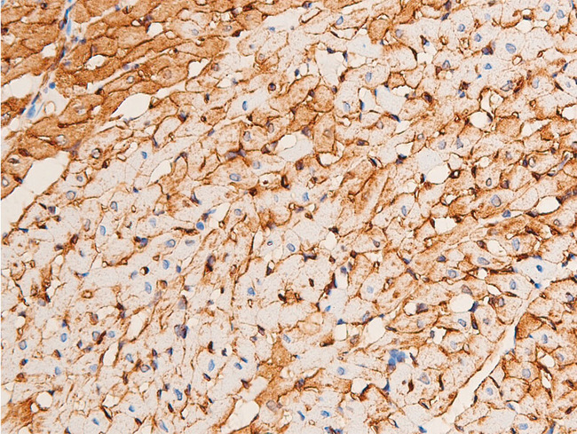 CHEK1 / CHK1 Antibody - 1:100 staining rat heart tissue by IHC-P. The tissue was formaldehyde fixed and a heat mediated antigen retrieval step in citrate buffer was performed. The tissue was then blocked and incubated with the antibody for 1.5 hours at 22°C. An HRP conjugated goat anti-rabbit antibody was used as the secondary.