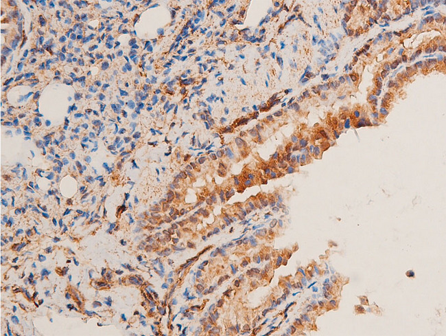 CHEK1 / CHK1 Antibody - 1:100 staining rat lung tissue by IHC-P. The tissue was formaldehyde fixed and a heat mediated antigen retrieval step in citrate buffer was performed. The tissue was then blocked and incubated with the antibody for 1.5 hours at 22°C. An HRP conjugated goat anti-rabbit antibody was used as the secondary.