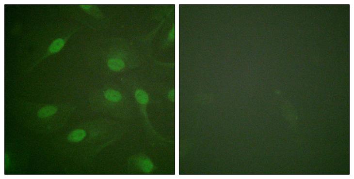 CHEK1 / CHK1 Antibody - Immunofluorescence analysis of HeLa cells, using Chk1 (Phospho-Ser301) Antibody. The picture on the right is blocked with the phospho peptide.