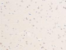 CHEK1 / CHK1 Antibody - 1:100 staining rat brain tissue by IHC-P. The tissue was formaldehyde fixed and a heat mediated antigen retrieval step in citrate buffer was performed. The tissue was then blocked and incubated with the antibody for 1.5 hours at 22°C. An HRP conjugated goat anti-rabbit antibody was used as the secondary.