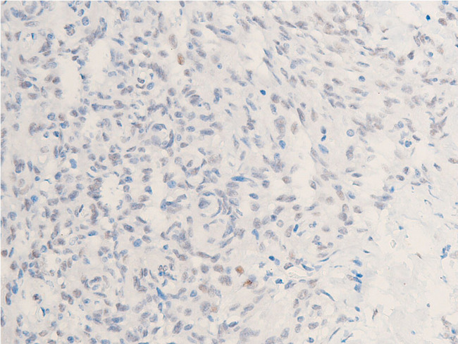 CHEK1 / CHK1 Antibody - 1:100 staining human lymphoid tissue by IHC-P. The tissue was formaldehyde fixed and a heat mediated antigen retrieval step in citrate buffer was performed. The tissue was then blocked and incubated with the antibody for 1.5 hours at 22°C. An HRP conjugated goat anti-rabbit antibody was used as the secondary.