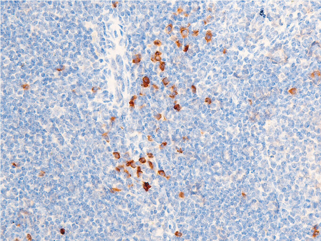 CHEK1 / CHK1 Antibody - 1:100 staining mouse spleen tissue by IHC-P. The tissue was formaldehyde fixed and a heat mediated antigen retrieval step in citrate buffer was performed. The tissue was then blocked and incubated with the antibody for 1.5 hours at 22°C. An HRP conjugated goat anti-rabbit antibody was used as the secondary.