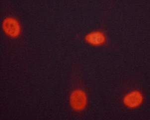 CHEK1 / CHK1 Antibody - Staining HeLa cells by IF/ICC. The samples were fixed with PFA and permeabilized in 0.1% saponin prior to blocking in 10% serum for 45 min at 37°C. The primary antibody was diluted 1/400 and incubated with the sample for 1 hour at 37°C. A Alexa Fluor® 594 conjugated goat polyclonal to rabbit IgG (H+L), diluted 1/600 was used as secondary antibody.