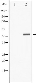 CHEK1 / CHK1 Antibody - Western blot analysis of Chk1 phosphorylation expression in 293 whole cells lysates. The lane on the left is treated with the antigen-specific peptide.