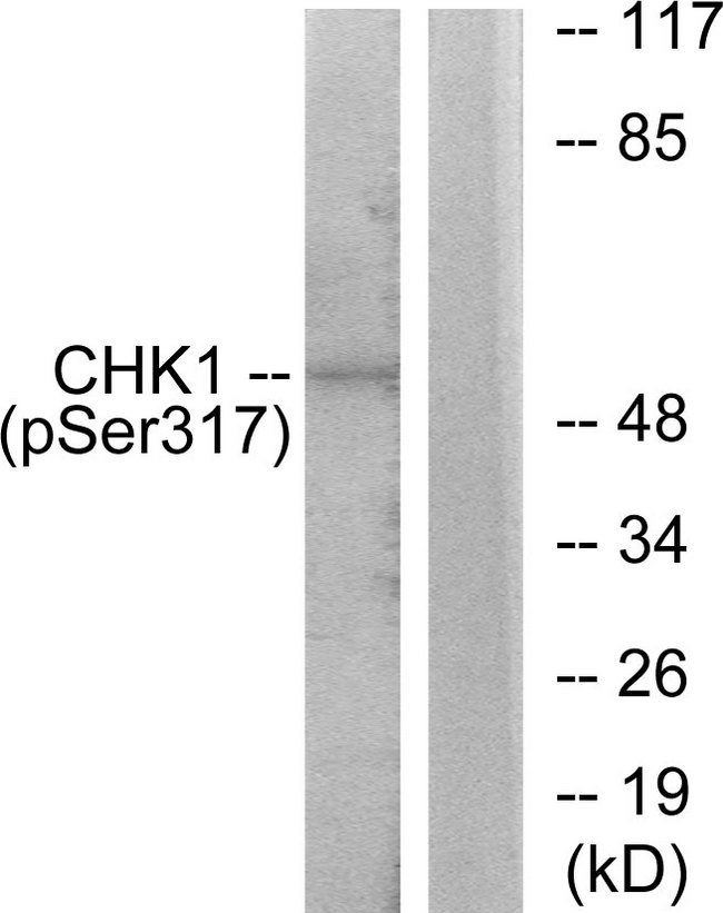 CHEK1 / CHK1 Antibody - Western blot analysis of lysates from MCF7 cells, using Chk1 (Phospho-Ser317) Antibody. The lane on the right is blocked with the phospho peptide.