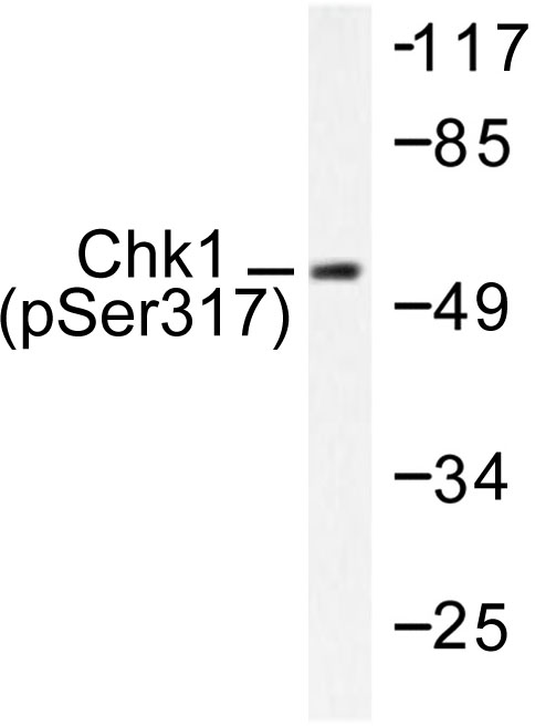 CHEK1 / CHK1 Antibody - Western blot of p-Chk1 (S317) pAb in extracts from MCF7 cells.