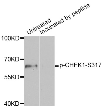 CHEK1 / CHK1 Antibody - Western blot analysis of extracts of MCF7 cells.