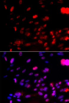 CHEK1 / CHK1 Antibody - Immunofluorescence analysis of U2OS cells.