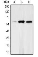 CHEK1 / CHK1 Antibody - Western blot analysis of CHK1 (pS317) expression in HeLa (A); mouse kidney (B); rat heart (C) whole cell lysates.