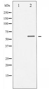 CHEK1 / CHK1 Antibody - Western blot of Chk1 phosphorylation expression in MCF7 whole cell lysates,The lane on the left is treated with the antigen-specific peptide.
