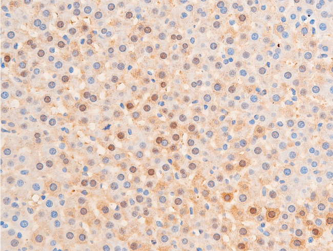 CHEK1 / CHK1 Antibody - 1:100 staining rat liver tissue by IHC-P. The tissue was formaldehyde fixed and a heat mediated antigen retrieval step in citrate buffer was performed. The tissue was then blocked and incubated with the antibody for 1.5 hours at 22°C. An HRP conjugated goat anti-rabbit antibody was used as the secondary.
