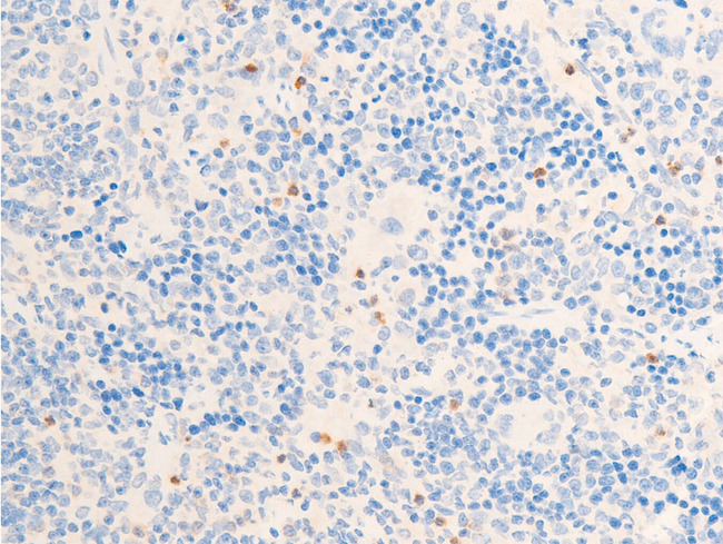 CHEK1 / CHK1 Antibody - 1:100 staining rat spleen tissue by IHC-P. The tissue was formaldehyde fixed and a heat mediated antigen retrieval step in citrate buffer was performed. The tissue was then blocked and incubated with the antibody for 1.5 hours at 22°C. An HRP conjugated goat anti-rabbit antibody was used as the secondary.