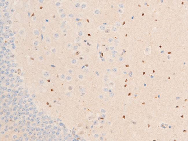 CHEK1 / CHK1 Antibody - 1:100 staining mouse brain tissue by IHC-P. The tissue was formaldehyde fixed and a heat mediated antigen retrieval step in citrate buffer was performed. The tissue was then blocked and incubated with the antibody for 1.5 hours at 22°C. An HRP conjugated goat anti-rabbit antibody was used as the secondary.