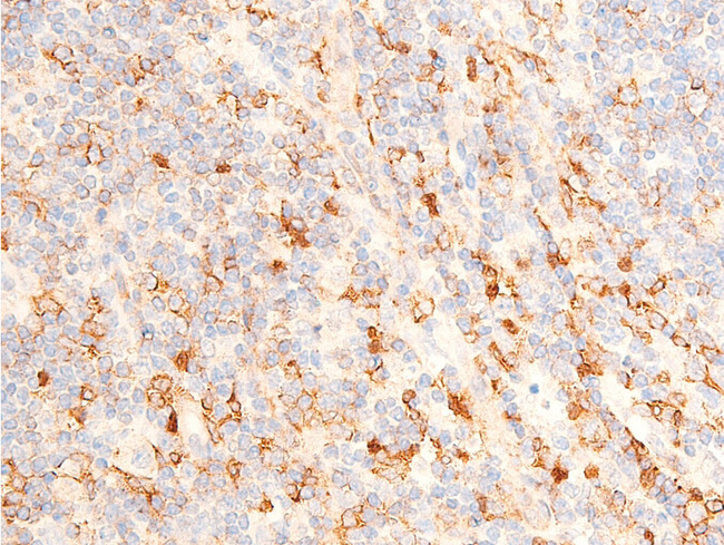 CHEK1 / CHK1 Antibody - 1:100 staining human appendix tissue by IHC-P. The tissue was formaldehyde fixed and a heat mediated antigen retrieval step in citrate buffer was performed. The tissue was then blocked and incubated with the antibody for 1.5 hours at 22°C. An HRP conjugated goat anti-rabbit antibody was used as the secondary.