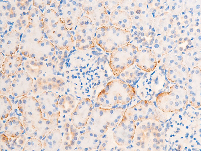 CHEK1 / CHK1 Antibody - 1:100 staining rat kidney tissue by IHC-P. The tissue was formaldehyde fixed and a heat mediated antigen retrieval step in citrate buffer was performed. The tissue was then blocked and incubated with the antibody for 1.5 hours at 22°C. An HRP conjugated goat anti-rabbit antibody was used as the secondary.