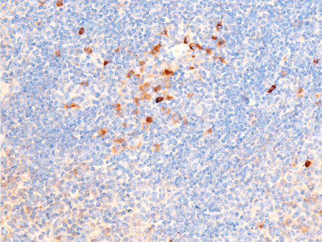 CHEK1 / CHK1 Antibody - 1:100 staining mouse spleen tissue by IHC-P. The tissue was formaldehyde fixed and a heat mediated antigen retrieval step in citrate buffer was performed. The tissue was then blocked and incubated with the antibody for 1.5 hours at 22°C. An HRP conjugated goat anti-rabbit antibody was used as the secondary.