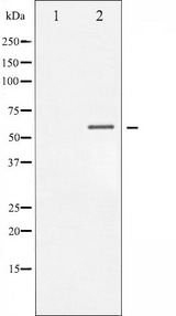 CHEK1 / CHK1 Antibody - Western blot analysis of Chk1 phosphorylation expression in MCF-7 whole cells lysates. The lane on the left is treated with the antigen-specific peptide.