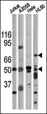 CHEK1 / CHK1 Antibody - The anti-Phospho-CHK1-S317 antibody is used in Western blot for detection in, from left to right, Jurkat, A2058, HeLa, and HL60 tissue lysates.