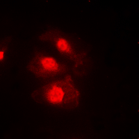 CHEK1 / CHK1 Antibody - Immunofluorescent analysis of CHK1 (pS345) staining in HeLa cells. Formalin-fixed cells were permeabilized with 0.1% Triton X-100 in TBS for 5-10 minutes and blocked with 3% BSA-PBS for 30 minutes at room temperature. Cells were probed with the primary antibody in 3% BSA-PBS and incubated overnight at 4 ??C in a humidified chamber. Cells were washed with PBST and incubated with a DyLight 594-conjugated secondary antibody (red) in PBS at room temperature in the dark. DAPI was used to stain the cell nuclei (blue).