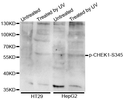 CHEK1 / CHK1 Antibody - Western blot analysis of extracts of various cell lines.